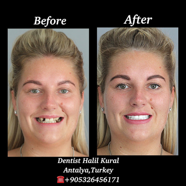 Slider image (2) Dr. Halil Kural